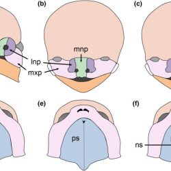 Cleft palate lip syndrome digeorge surgery lips kidshealth bilateral quotes speech treatment categories after quotesgram types pediatric development left mouth