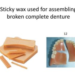 Sticky wax uses in dentistry