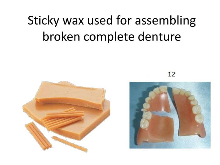 Sticky wax uses in dentistry