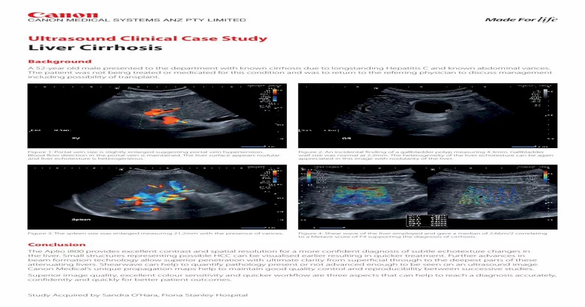 Case study about liver cirrhosis