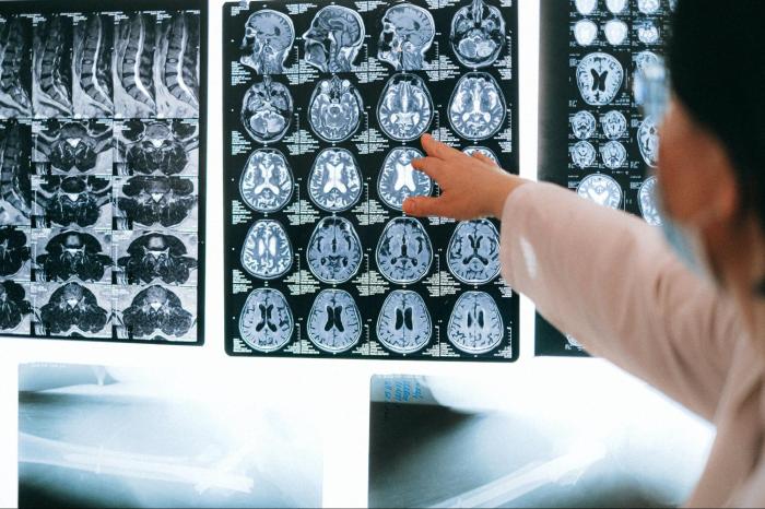 Correctly label the following functional regions of the cerebral cortex.